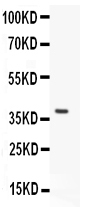 WB - Anti-LKB1 Picoband Antibody ABO11961